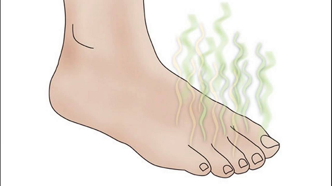 medicated insoles for smelly feet